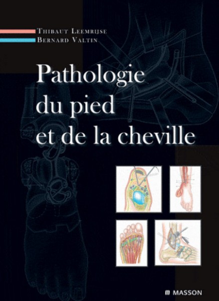 Pathologie du pied et de la cheville