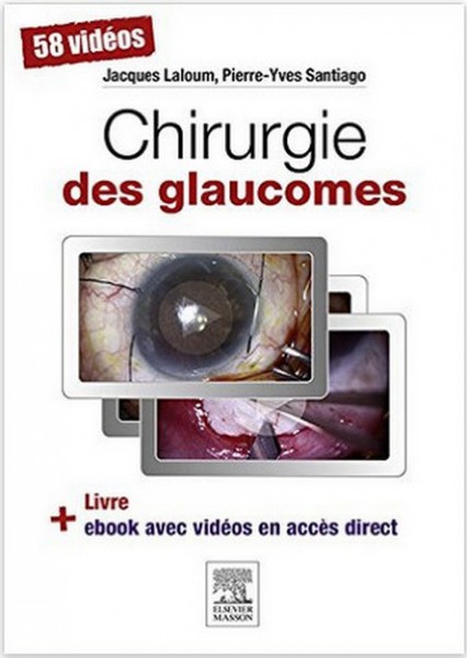 Chirurgie des glaucomes